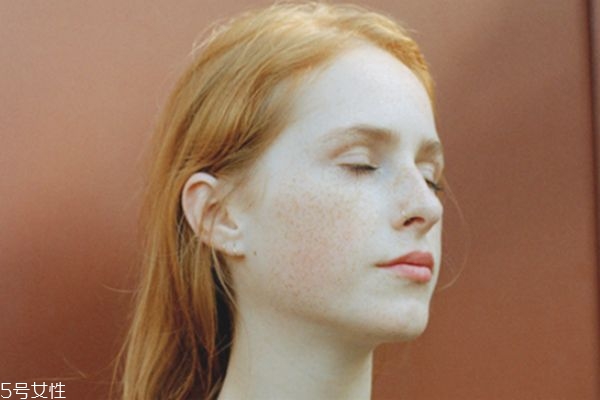 臉上有好多斑怎樣祛斑 激光祛斑才夠徹底 臉上有好多斑怎樣祛斑 激光祛斑才夠徹底