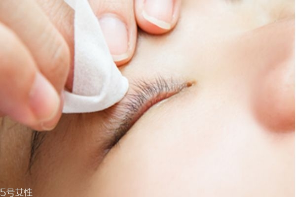 嫁接睫毛脫落怎么辦 正確護(hù)理保持更長時(shí)間 嫁接睫毛脫落怎么辦 正確護(hù)理保持更長時(shí)間