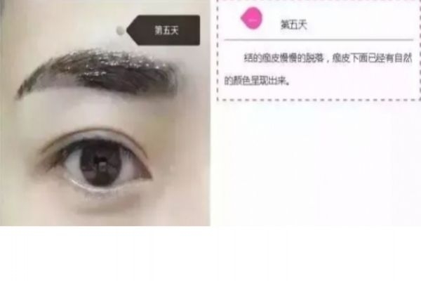紋眉幾天會變細 紋眉七天的變化 紋眉幾天會變細 紋眉七天的變化