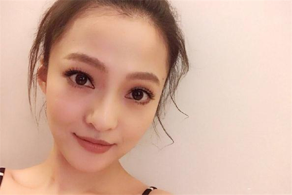 激光祛紅血絲多久見效 激光去紅血絲幾天能見效 激光祛紅血絲多久見效 激光去紅血絲幾天能見效