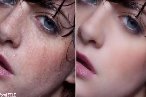 果酸換膚多久做一次 果酸換膚間隔時間 果酸換膚多久做一次 果酸換膚間隔時間