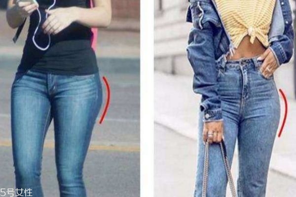 假胯寬能矯正過來嗎 假胯寬多久能矯正過來 假胯寬能矯正過來嗎 假胯寬多久能矯正過來