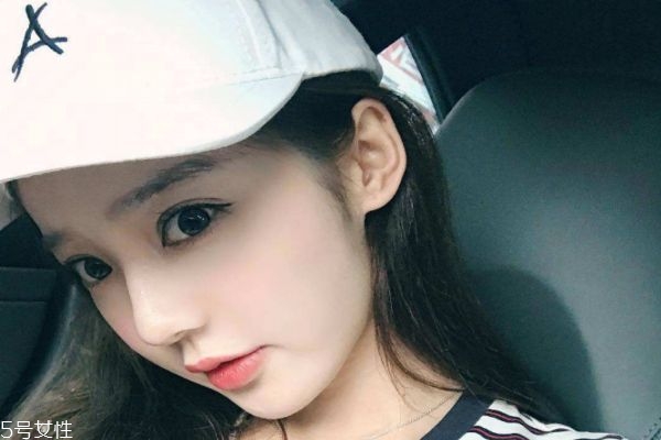 做鼻基底填充能改善法令紋嗎 有一定改善 做鼻基底填充能改善法令紋嗎 有一定改善