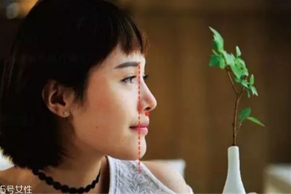 做鼻基底填充能改善法令紋嗎 有一定改善 做鼻基底填充能改善法令紋嗎 有一定改善