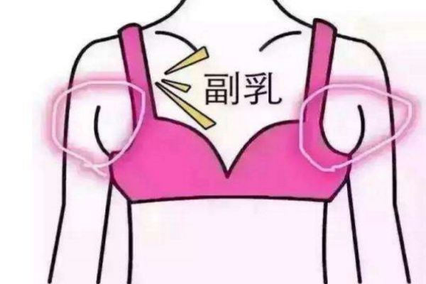 如何去副乳的方法 減掉副乳的最快方法 如何去副乳的方法 減掉副乳的最快方法