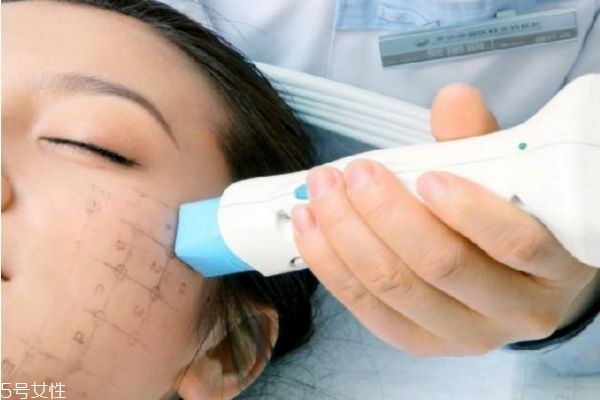 熱瑪吉幾天后可以化妝 熱瑪吉多久恢復(fù) 熱瑪吉幾天后可以化妝 熱瑪吉多久恢復(fù)