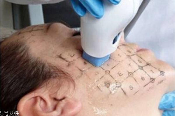 熱瑪吉幾天后可以化妝 熱瑪吉多久恢復(fù) 熱瑪吉幾天后可以化妝 熱瑪吉多久恢復(fù)