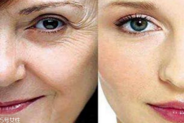 熱瑪吉會溶脂嗎 熱瑪吉適合范圍 熱瑪吉會溶脂嗎 熱瑪吉適合范圍