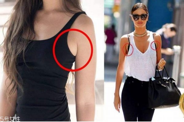 如何去副乳的方法 減掉副乳的最快方法 如何去副乳的方法 減掉副乳的最快方法