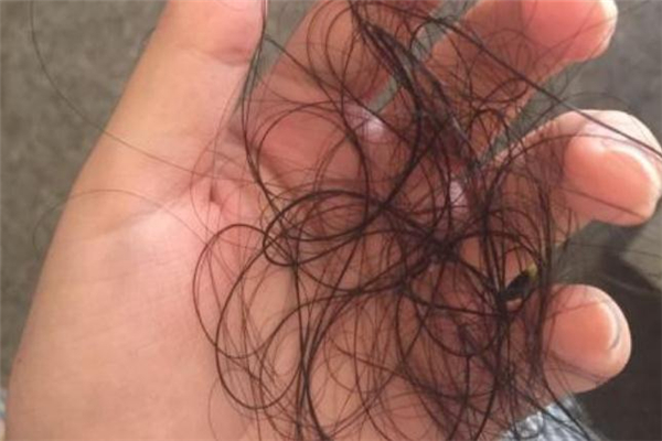 掉落的頭發(fā)是什么垃圾 碎頭發(fā)是干垃圾還是濕垃圾 掉落的頭發(fā)是什么垃圾 碎頭發(fā)是干垃圾還是濕垃圾