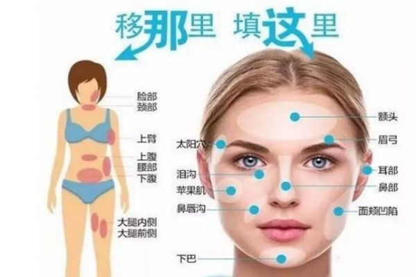 脂肪填充多久擦護膚品 脂肪填充多久用洗面奶 脂肪填充多久擦護膚品 脂肪填充多久用洗面奶