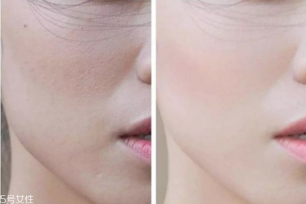 臉部皮膚粗糙怎么辦 涂臉的正確步驟