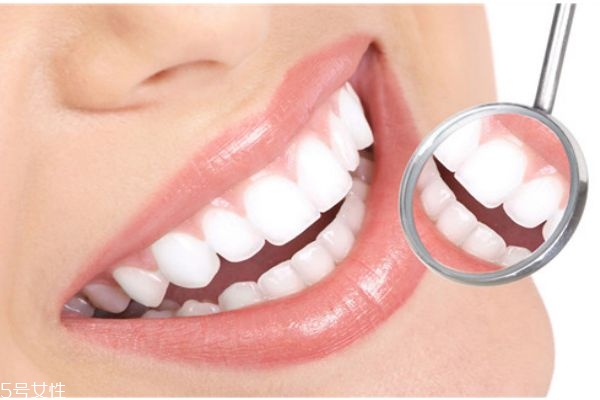 什么是牙結(jié)石 牙結(jié)石的形成原因