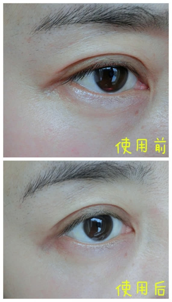 VIIcode夜間氧眼貼抗老效果怎么樣？VIIcode眼膜使用測評