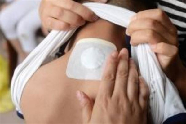 三伏貼可以在不同醫(yī)院貼嗎 三伏貼可以在不同地方貼嗎 三伏貼可以在不同醫(yī)院貼嗎 三伏貼可以在不同地方貼嗎