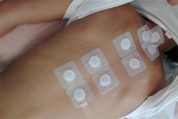 貼三伏貼可以洗頭發(fā)嗎 貼三伏貼洗頭有影響嗎 貼三伏貼可以洗頭發(fā)嗎 貼三伏貼洗頭有影響嗎