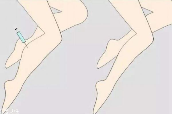 打完瘦腿針又大了一圈怎么回事 打瘦腿針可以瘦多少 打完瘦腿針又大了一圈怎么回事 打瘦腿針可以瘦多少