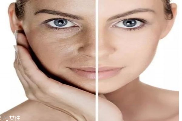 眼袋大是什么原因 眼袋下垂怎么消除 眼袋大是什么原因 眼袋下垂怎么消除