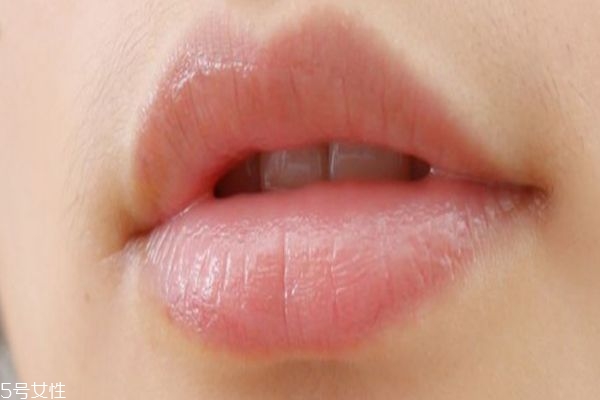 夏天為什么容易嘴巴起皮呢 如何治療嘴巴起皮呢 夏天為什么容易嘴巴起皮呢 如何治療嘴巴起皮呢