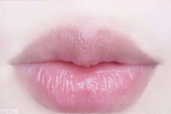 為什么唇色深 天生唇色深是什么原因 為什么唇色深 天生唇色深是什么原因