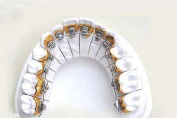 支抗釘有哪些用途 什么情況需要打支抗釘 支抗釘有哪些用途 什么情況需要打支抗釘