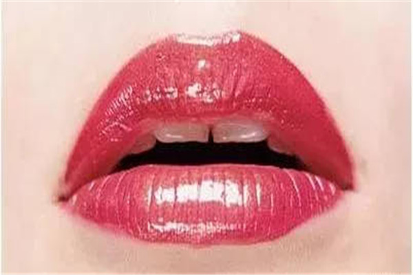 嘴角上揚手術(shù)后悔了怎么辦 嘴角上揚手術(shù)失敗 嘴角上揚手術(shù)后悔了怎么辦 嘴角上揚手術(shù)失敗