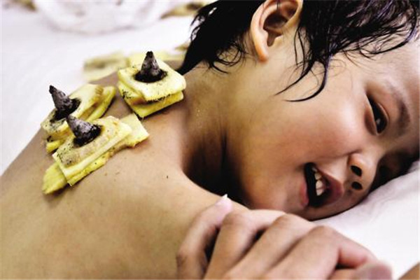 三伏貼起泡幾天能好 三伏貼起泡不要抓撓 三伏貼起泡幾天能好 三伏貼起泡不要抓撓