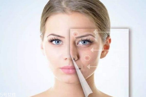 怎樣能使皮膚白嫩細膩 使皮膚變白嫩細膩的方法 怎樣能使皮膚白嫩細膩 使皮膚變白嫩細膩的方法