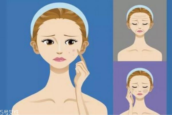 什么是光子嫩膚呢 光子嫩膚有什么原理呢 什么是光子嫩膚呢 光子嫩膚有什么原理呢