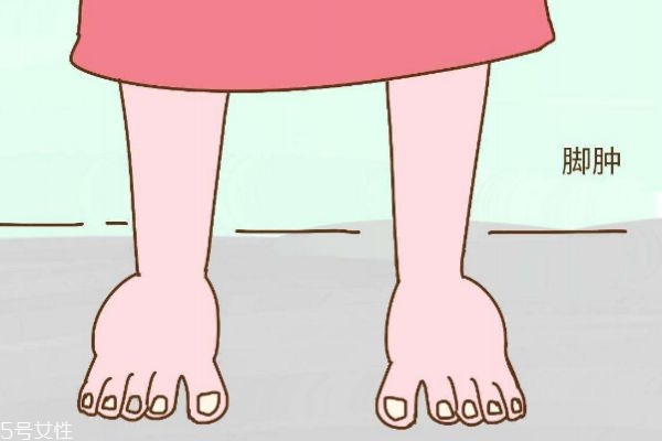 人為什么會水腫呢 水腫是什么呢 人為什么會水腫呢 水腫是什么呢