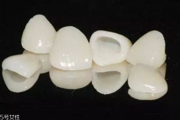 牙齒泛黃應該怎么辦呢 為什么牙齒會泛黃 牙齒泛黃應該怎么辦呢 為什么牙齒會泛黃