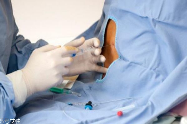 什么叫無痛分娩 無痛分娩是怎樣的 什么叫無痛分娩 無痛分娩是怎樣的