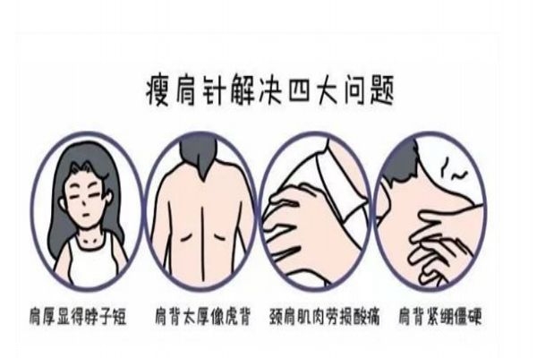 瘦肩針一次要打多少毫升呢 瘦肩針有什么副作用呢 瘦肩針一次要打多少毫升呢 瘦肩針有什么副作用呢