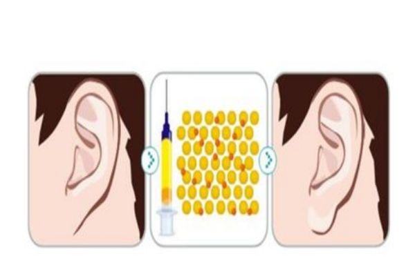 豐耳垂有什么注意事項(xiàng)嗎 破尿酸豐耳垂有什么好處呢 豐耳垂有什么注意事項(xiàng)嗎 破尿酸豐耳垂有什么好處呢