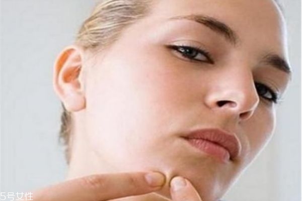 下巴長痘痘怎么辦 下巴長痘痘這樣調理 下巴長痘痘怎么辦 下巴長痘痘這樣調理