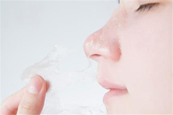 隆鼻是全麻還是局麻好 隆鼻選擇什么麻醉 隆鼻是全麻還是局麻好 隆鼻選擇什么麻醉