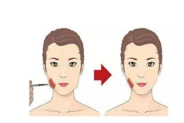 什么是咬肌呢 咬肌肥大怎么辦呢 什么是咬肌呢 咬肌肥大怎么辦呢