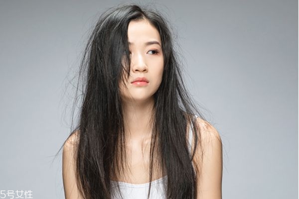 頭皮上的螨蟲怎么去除 頭上有螨蟲的征兆 頭皮上的螨蟲怎么去除 頭上有螨蟲的征兆