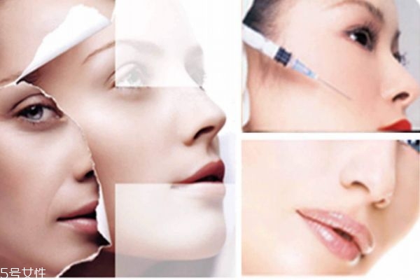 愛貝芙一針多少錢呢 愛貝芙一針可以持續(xù)多久呢 愛貝芙一針多少錢呢 愛貝芙一針可以持續(xù)多久呢