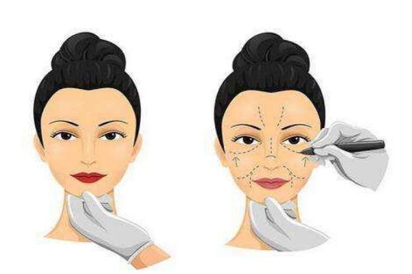 電波拉皮的多少錢一次呢 電波拉皮一次可以持續(xù)多久呢 電波拉皮的多少錢一次呢 電波拉皮一次可以持續(xù)多久呢