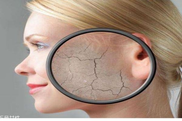 皮膚脫皮的原因有什么呢 為什么會(huì)皮膚脫皮呢 皮膚脫皮的原因有什么呢 為什么會(huì)皮膚脫皮呢