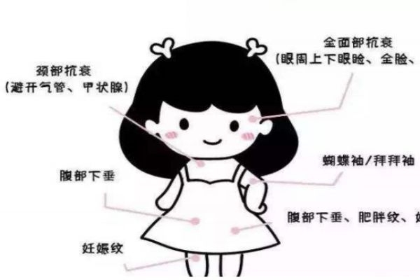 熱瑪吉適合什么年齡的人群做呢 熱瑪吉多久做一次呢 熱瑪吉適合什么年齡的人群做呢 熱瑪吉多久做一次呢