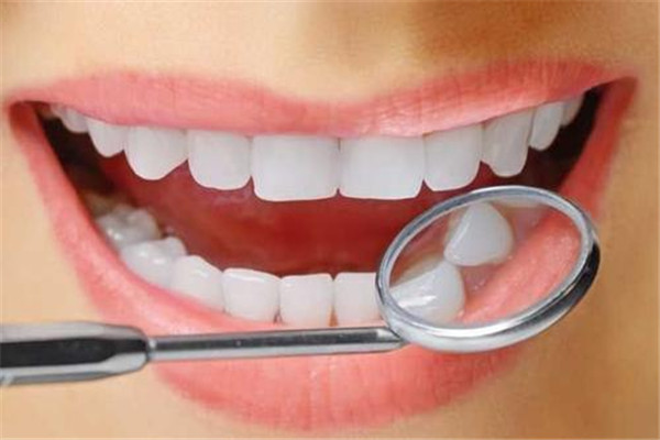 洗牙是自費(fèi)還是醫(yī)?？?洗牙價格是多少錢