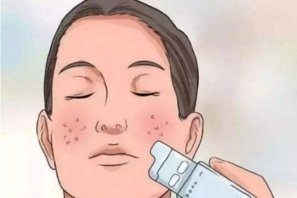 毛孔粗大怎么辦呢 為什么會毛孔粗大呢 毛孔粗大怎么辦呢 為什么會毛孔粗大呢