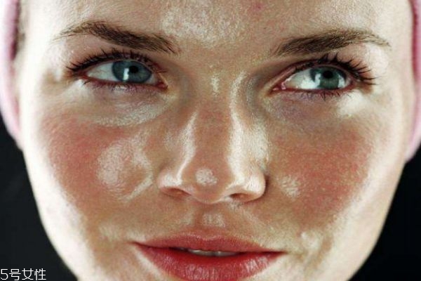 夏天臉上出油嚴重怎么辦 怎么樣緩解夏季臉部出油 夏天臉上出油嚴重怎么辦 怎么樣緩解夏季臉部出油