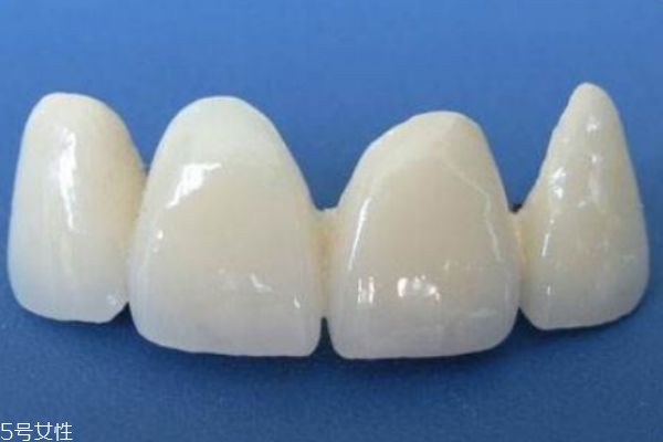 烤瓷牙有什么危害 做烤瓷牙的危害 烤瓷牙有什么危害 做烤瓷牙的危害
