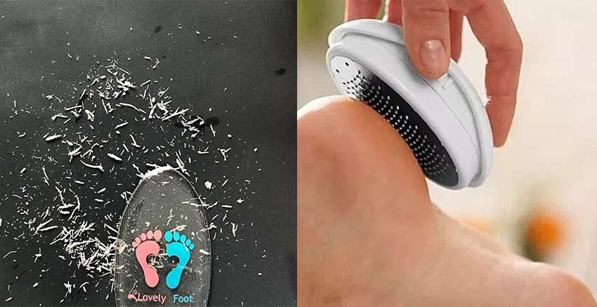 快速去死皮的磨腳器推薦 約會(huì)穿涼鞋不尷尬 快速去死皮的磨腳器推薦 約會(huì)穿涼鞋不尷尬