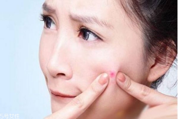 女生臉上長痘怎么調(diào)理 女生臉上長痘吃什么水果好 女生臉上長痘怎么調(diào)理 女生臉上長痘吃什么水果好