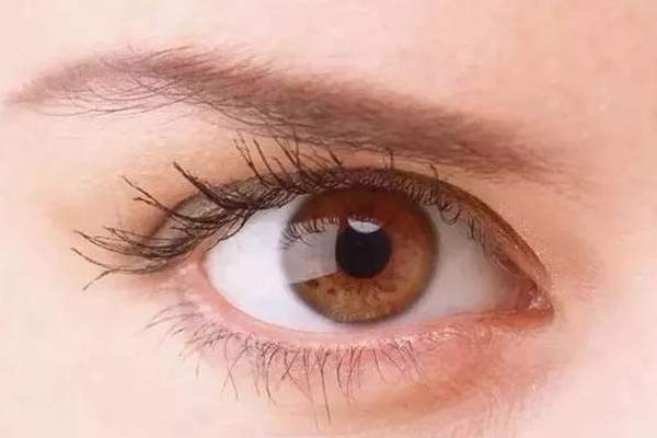 臥蠶與眼袋的區(qū)別 眼袋太重怎樣消除 臥蠶與眼袋的區(qū)別 眼袋太重怎樣消除