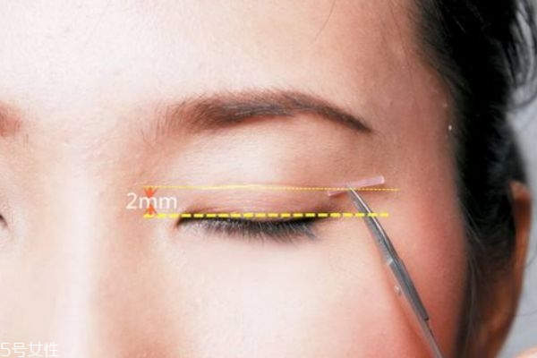 長期戴雙眼皮貼是不是會變成雙眼皮呢 長期戴雙眼皮貼是不是會變成雙眼皮呢